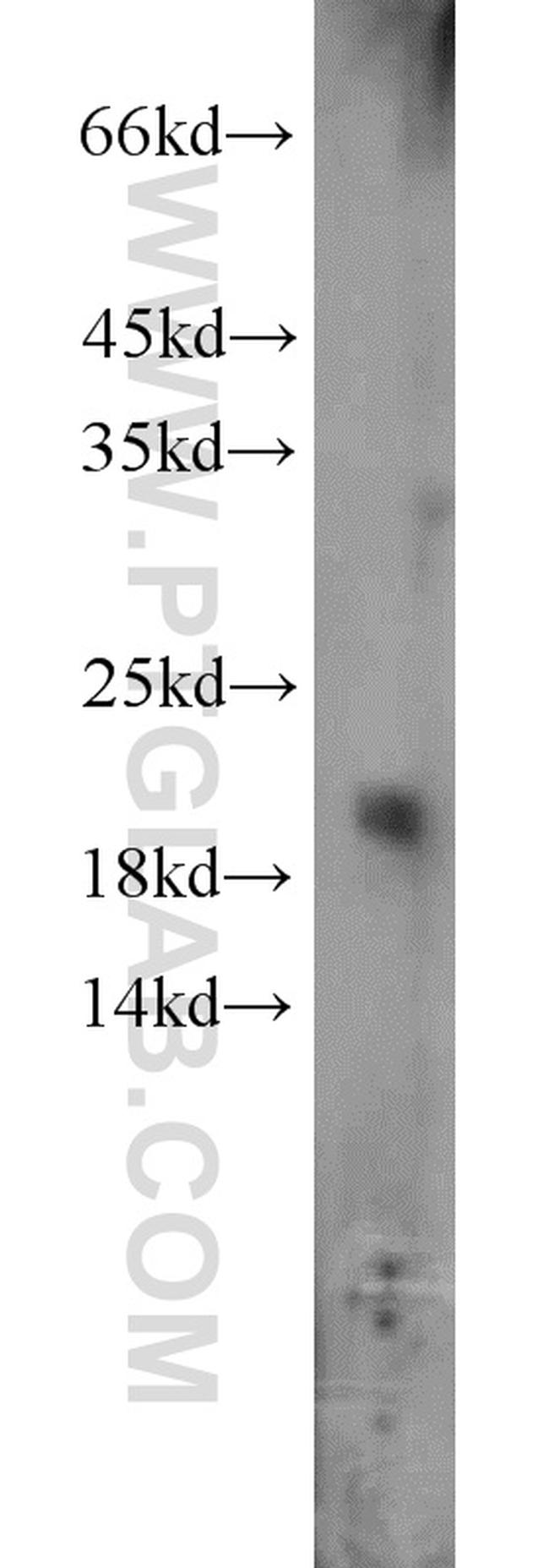 ARF3 Antibody in Western Blot (WB)