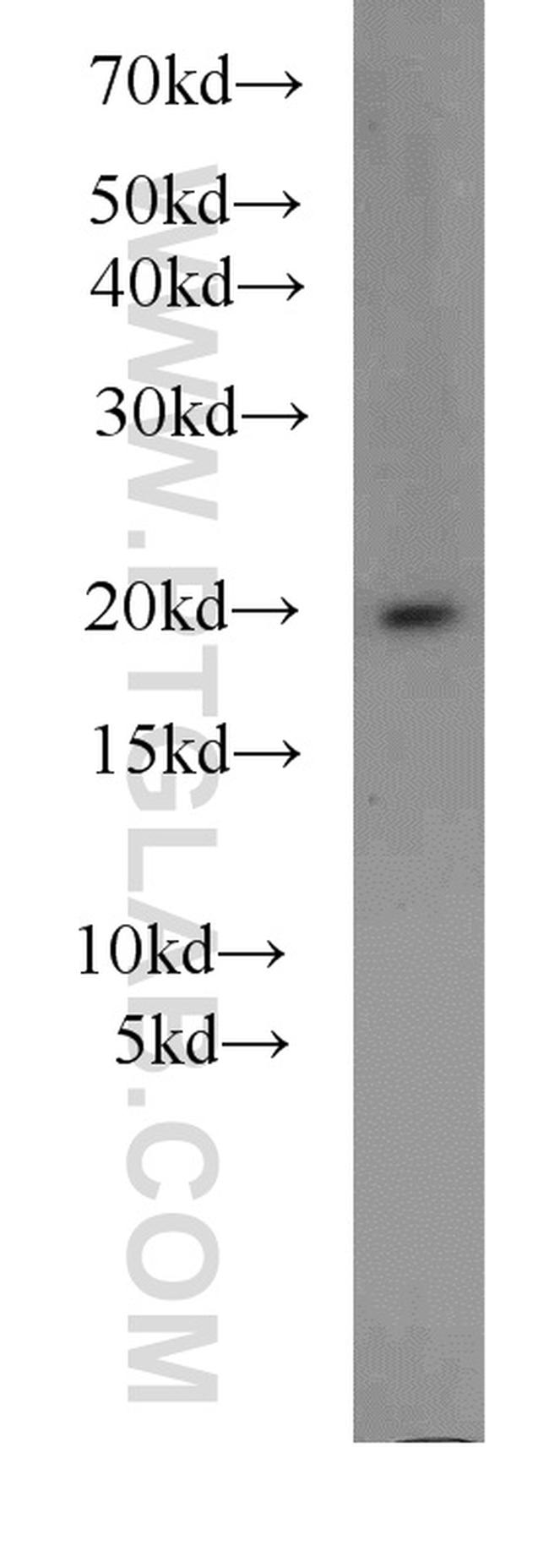 ARF3 Antibody in Western Blot (WB)