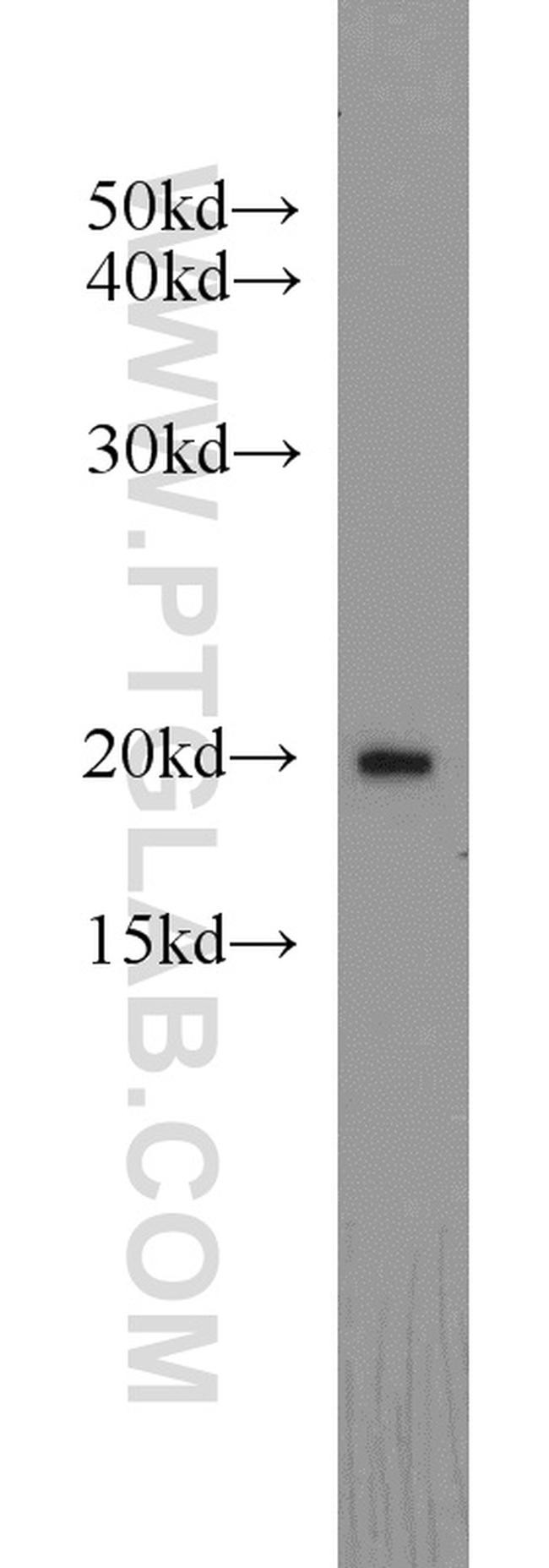 ARF3 Antibody in Western Blot (WB)