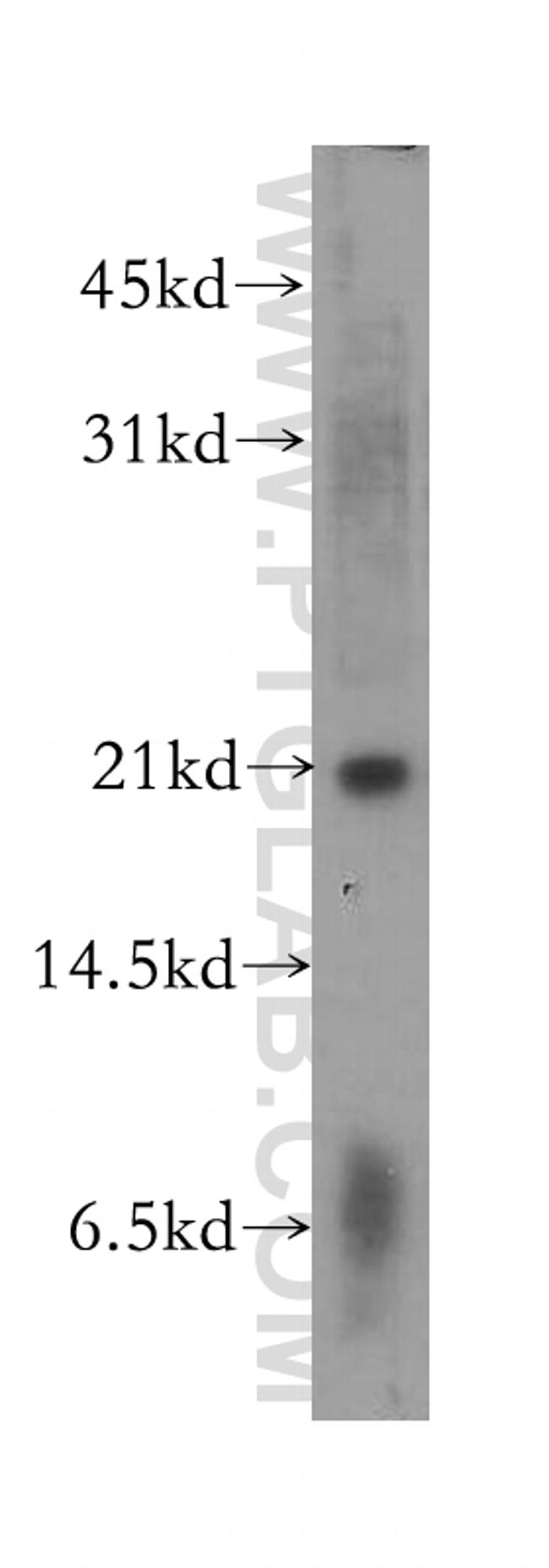 ARF3 Antibody in Western Blot (WB)