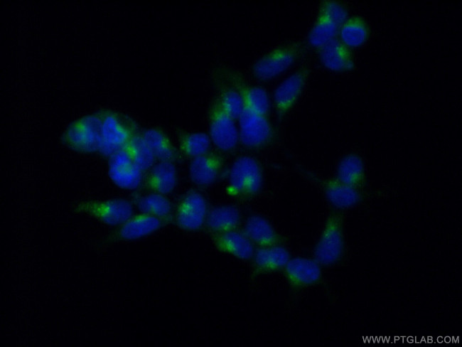 PSAP Antibody in Immunocytochemistry (ICC/IF)