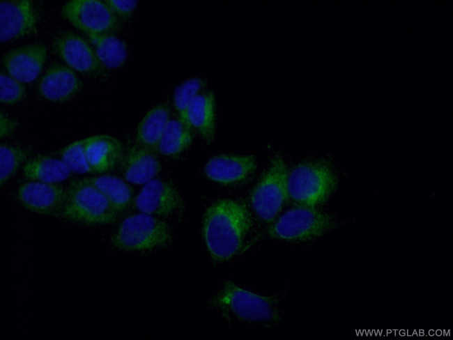 PSAP Antibody in Immunocytochemistry (ICC/IF)