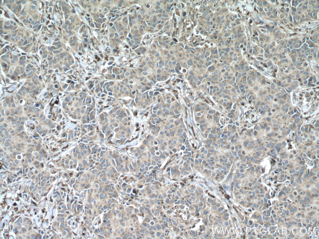 PSAP Antibody in Immunohistochemistry (Paraffin) (IHC (P))