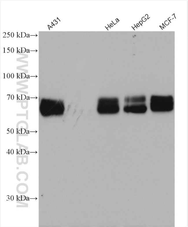 PSAP Antibody in Western Blot (WB)