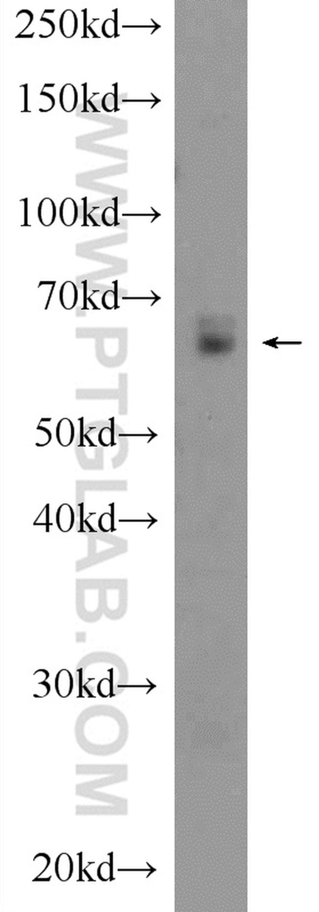 PSAP Antibody in Western Blot (WB)