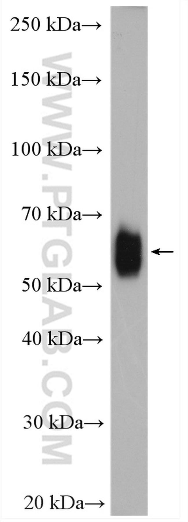 PSAP Antibody in Western Blot (WB)