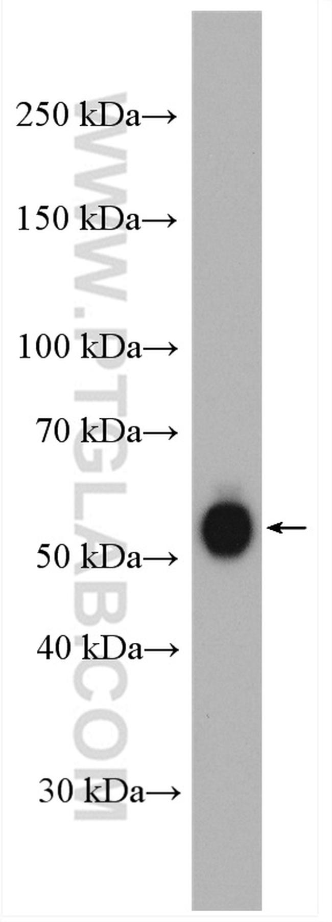 PSAP Antibody in Western Blot (WB)