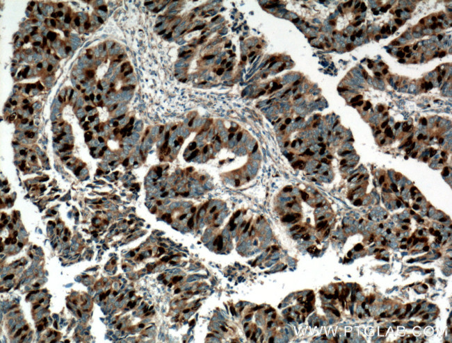 Geminin Antibody in Immunohistochemistry (Paraffin) (IHC (P))