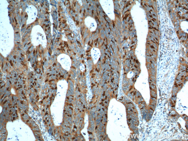 Geminin Antibody in Immunohistochemistry (Paraffin) (IHC (P))