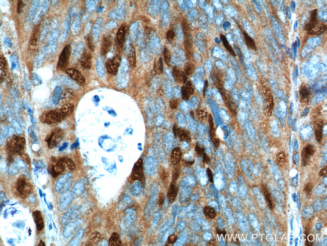 Geminin Antibody in Immunohistochemistry (Paraffin) (IHC (P))