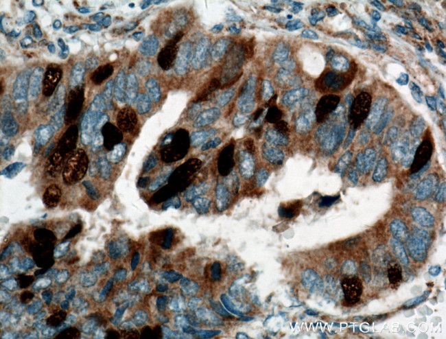 Geminin Antibody in Immunohistochemistry (Paraffin) (IHC (P))