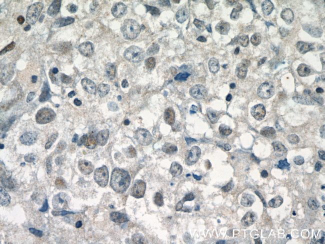 DDX5/p68 Antibody in Immunohistochemistry (Paraffin) (IHC (P))