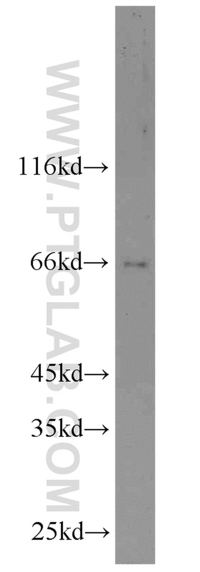 DDX5/p68 Antibody in Western Blot (WB)