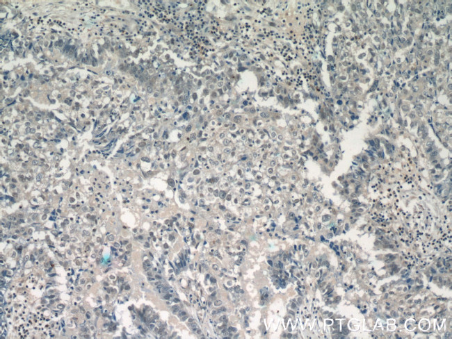 DDX5/p68 Antibody in Immunohistochemistry (Paraffin) (IHC (P))