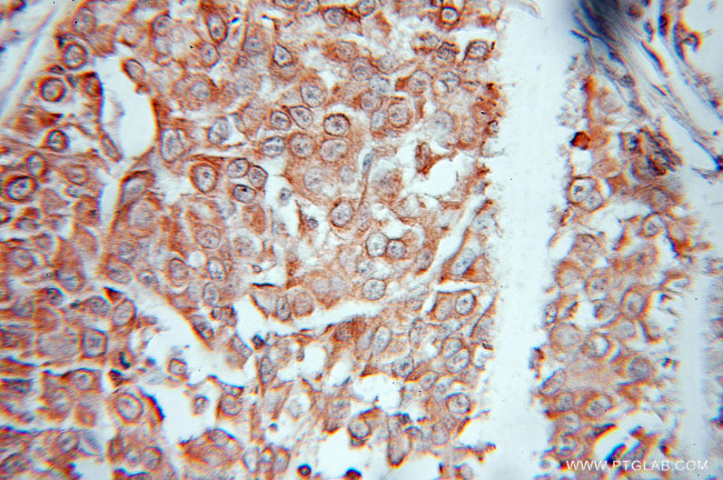 EEF1E1 Antibody in Immunohistochemistry (Paraffin) (IHC (P))