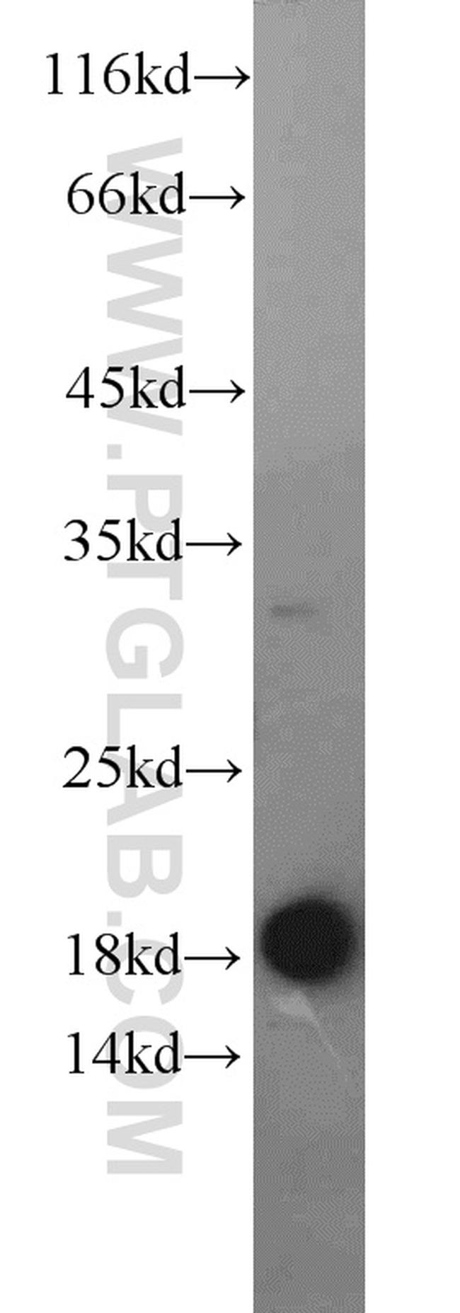 EEF1E1 Antibody in Western Blot (WB)