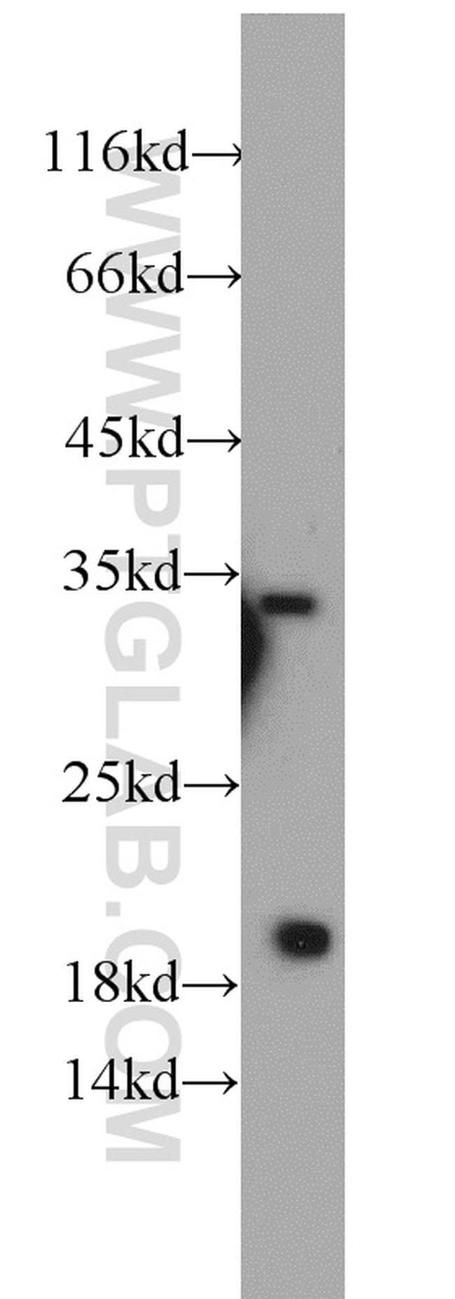 EEF1E1 Antibody in Western Blot (WB)