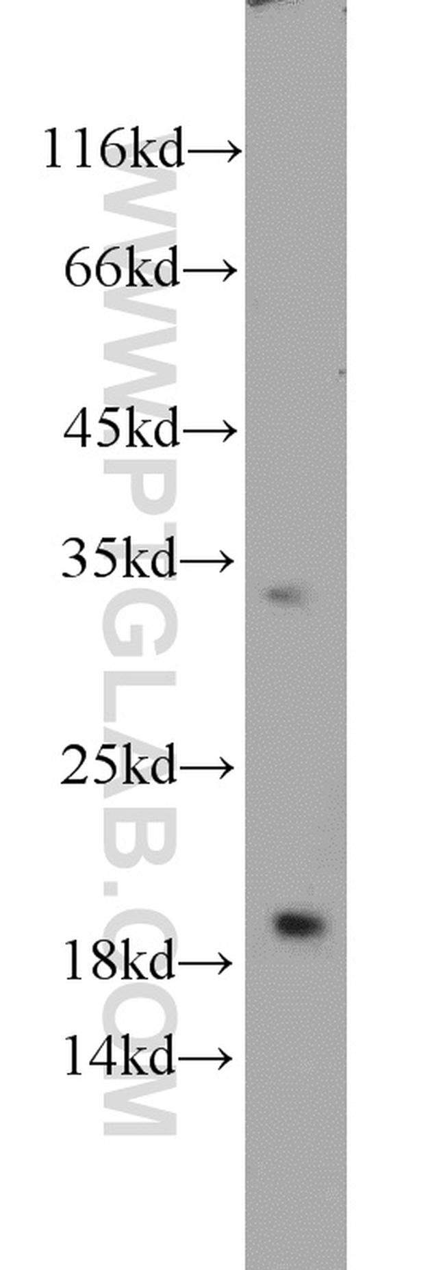 EEF1E1 Antibody in Western Blot (WB)