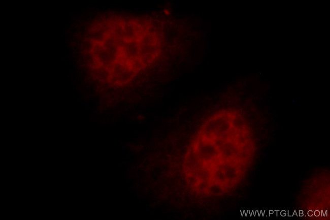 RFC4 Antibody in Immunocytochemistry (ICC/IF)