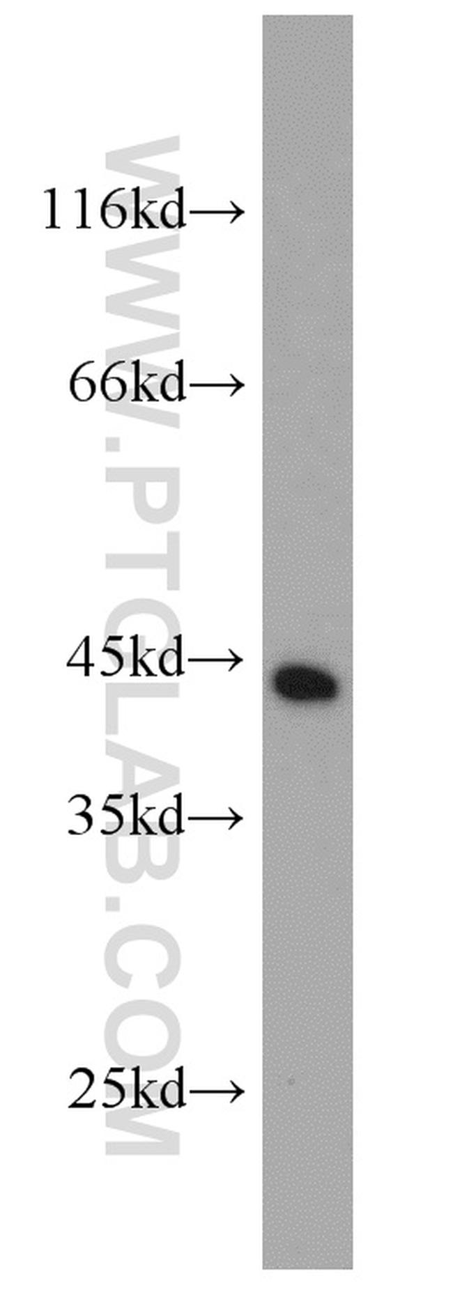 RFC4 Antibody in Western Blot (WB)