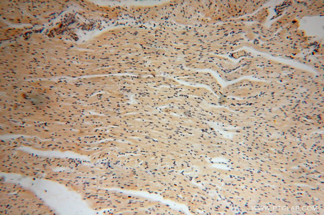 HERP Antibody in Immunohistochemistry (Paraffin) (IHC (P))