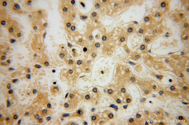 HERP Antibody in Immunohistochemistry (Paraffin) (IHC (P))