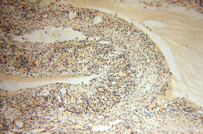 HERP Antibody in Immunohistochemistry (Paraffin) (IHC (P))