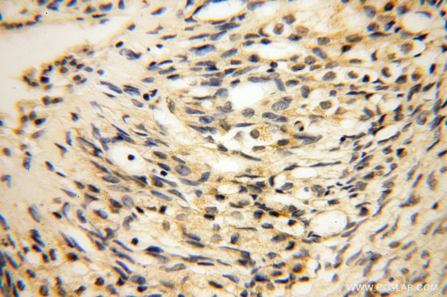 HERP Antibody in Immunohistochemistry (Paraffin) (IHC (P))