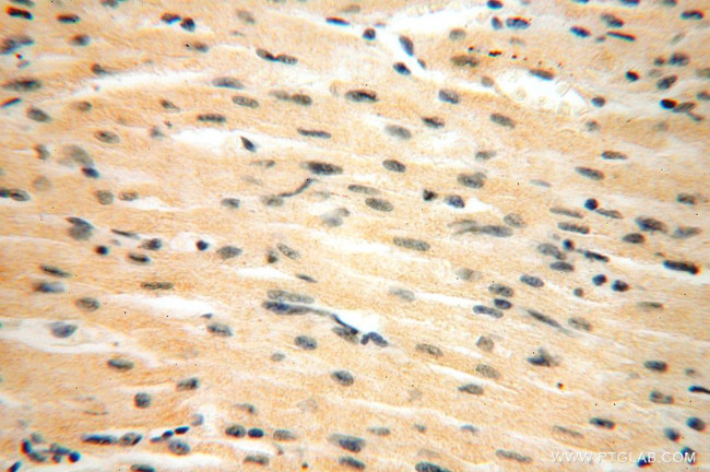 HERP Antibody in Immunohistochemistry (Paraffin) (IHC (P))