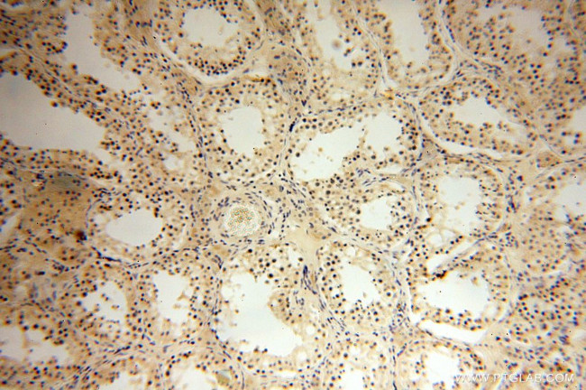 HERP Antibody in Immunohistochemistry (Paraffin) (IHC (P))