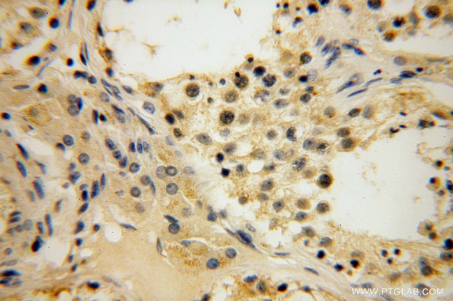 HERP Antibody in Immunohistochemistry (Paraffin) (IHC (P))