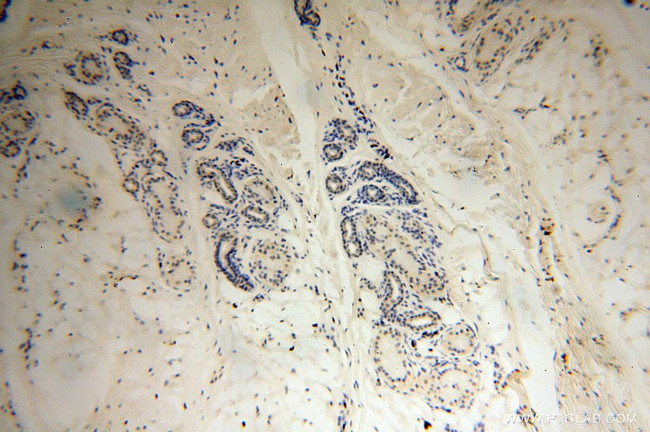 HERP Antibody in Immunohistochemistry (Paraffin) (IHC (P))