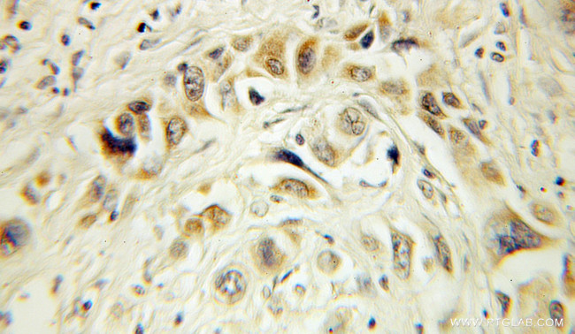 HERP Antibody in Immunohistochemistry (Paraffin) (IHC (P))