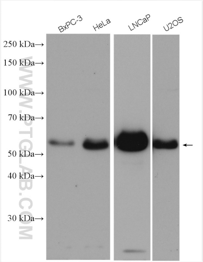 HERP Antibody in Western Blot (WB)