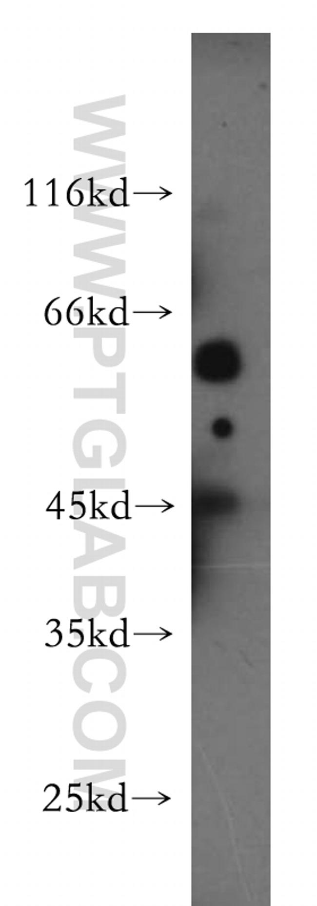 HERP Antibody in Western Blot (WB)