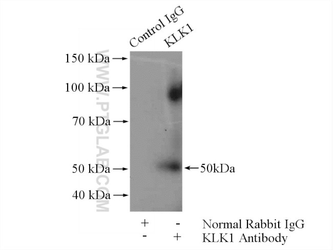 Kallikrein 1 Antibody in Immunoprecipitation (IP)