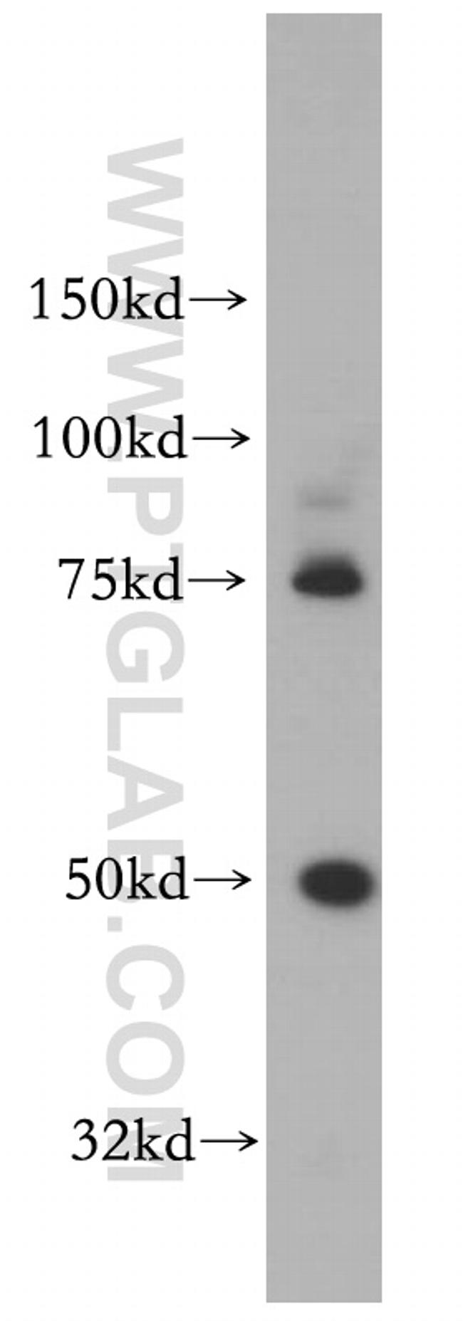 Kallikrein 1 Antibody in Western Blot (WB)