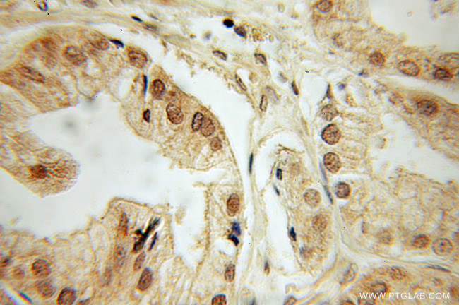 DEDD Antibody in Immunohistochemistry (Paraffin) (IHC (P))