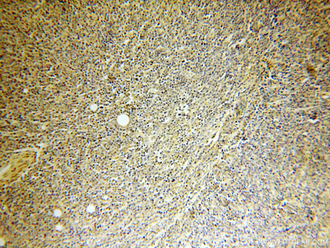 ERCC2 Antibody in Immunohistochemistry (Paraffin) (IHC (P))