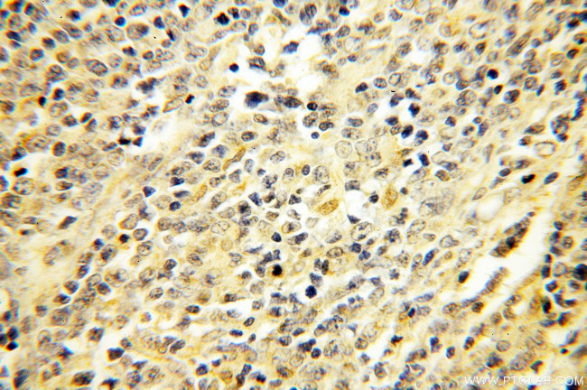 ERCC2 Antibody in Immunohistochemistry (Paraffin) (IHC (P))