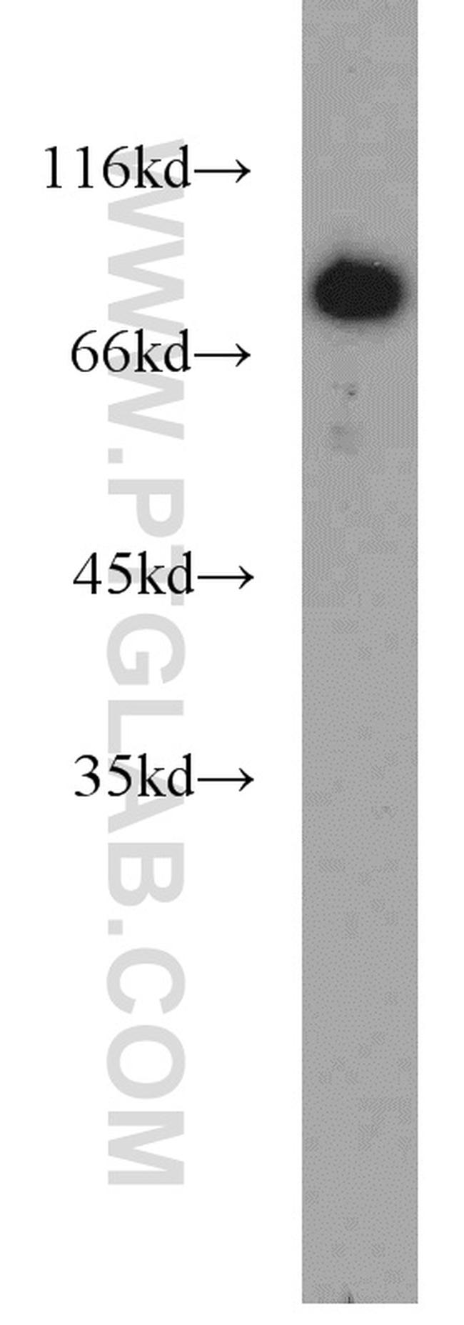 ERCC2 Antibody in Western Blot (WB)