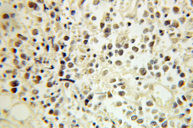 ERCC2 Antibody in Immunohistochemistry (Paraffin) (IHC (P))