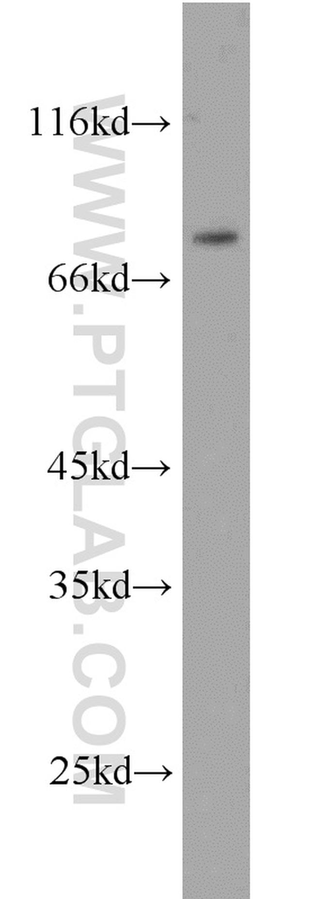 ERCC2 Antibody in Western Blot (WB)