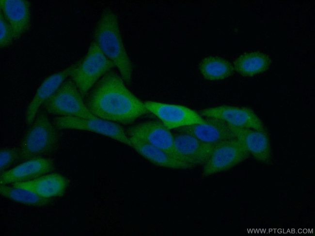 KPNA2 Antibody in Immunocytochemistry (ICC/IF)