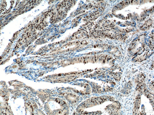 KPNA2 Antibody in Immunohistochemistry (Paraffin) (IHC (P))