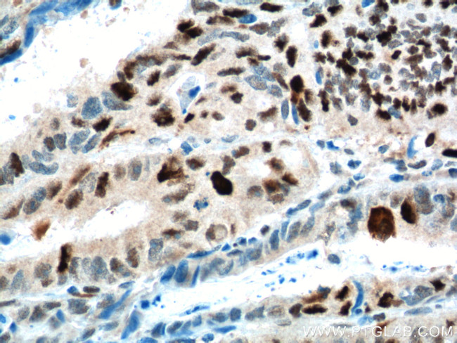 KPNA2 Antibody in Immunohistochemistry (Paraffin) (IHC (P))