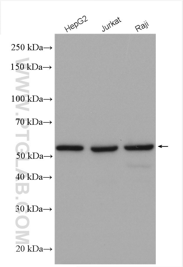 KPNA2 Antibody in Western Blot (WB)