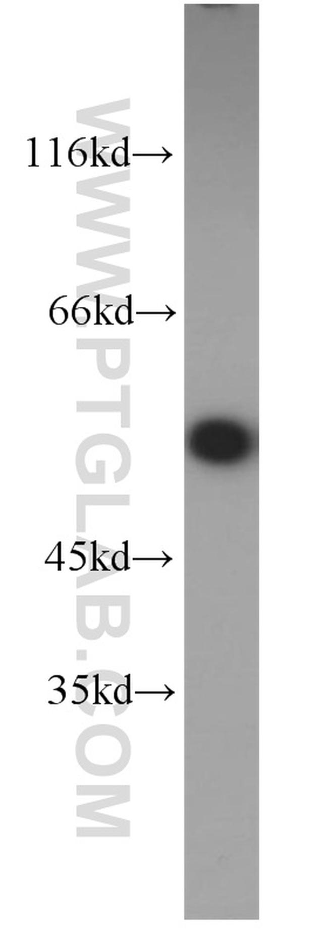 KPNA2 Antibody in Western Blot (WB)
