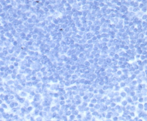 HCG-beta (Pregnancy and Choriocarcinoma Marker) Antibody in Immunohistochemistry (Paraffin) (IHC (P))