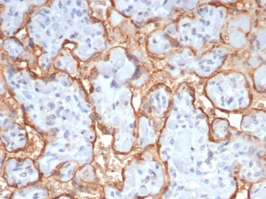 HCG-beta (Pregnancy and Choriocarcinoma Marker) Antibody in Immunohistochemistry (Paraffin) (IHC (P))